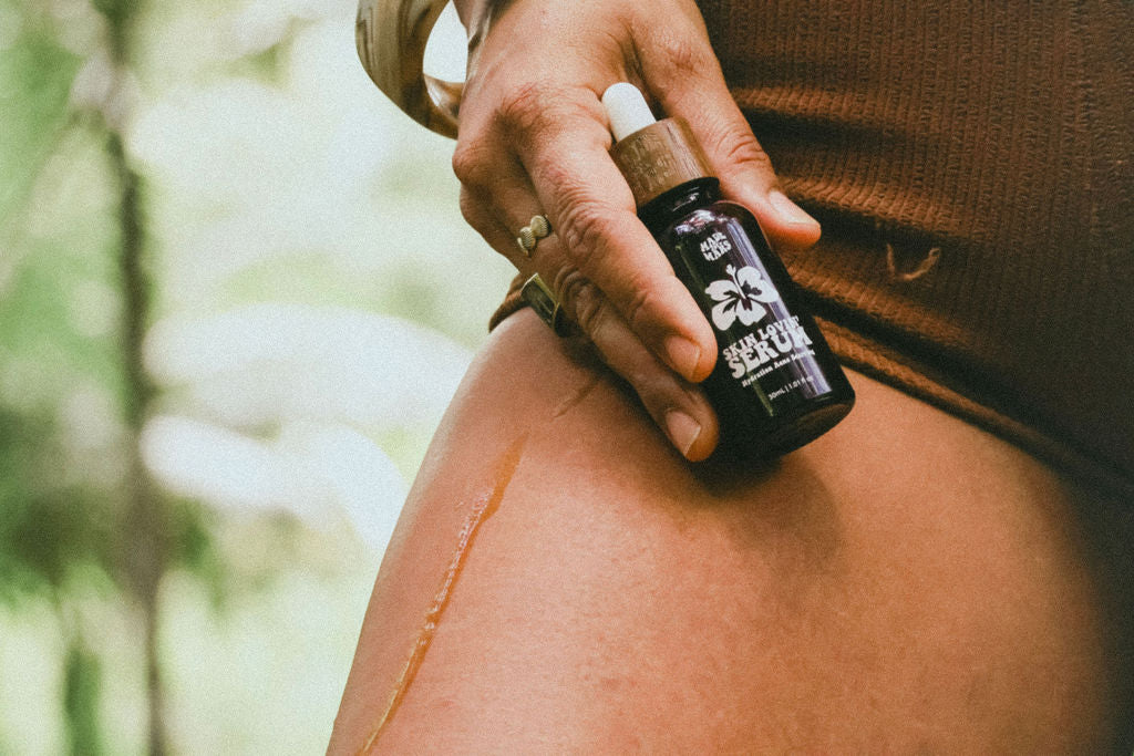 Skin Lovin’ Serum – Face & Body Oil for Blemish-Prone Skin