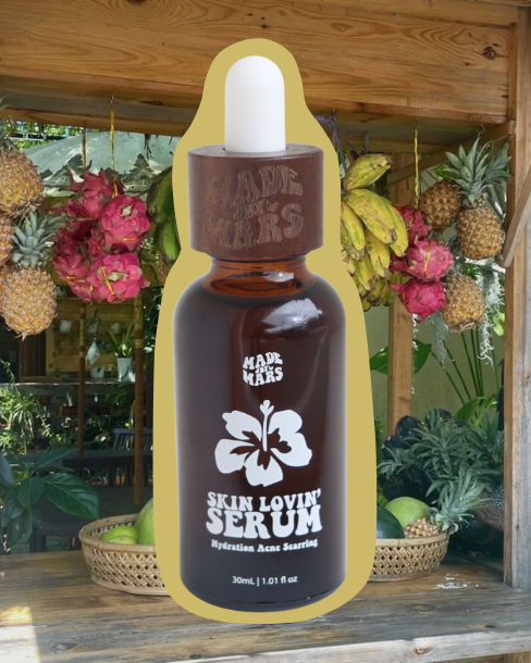 Skin Lovin’ Serum – Face & Body Oil for Blemish-Prone Skin