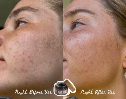 Charcoal Face Mask - Detox & Purify