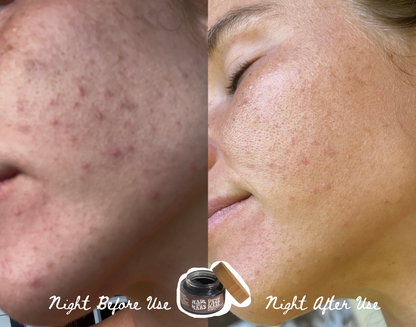 Charcoal Face Mask - Detox & Purify